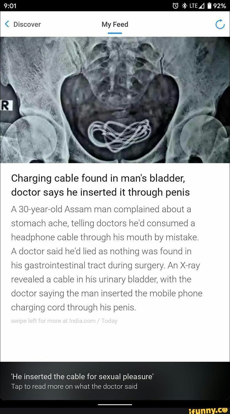 892%
My Feed
Charging cable found in man's bladder, doctor says he inserted it through penis
A 30-year-old Assam man complained about a stomach ache, telling doctors he'd consumed a headphone cable through his mouth by mistake.
A doctor said he'd lied as nothing was found in his gastrointestinal tract during surgery. An X-ray revealed a cable in his urinary bladder, with the doctor saying the man inserted the mobile phone charging cord through his penis.
'He inserted the cable for sexual pleasure'
Tap to read more on what the doctor said