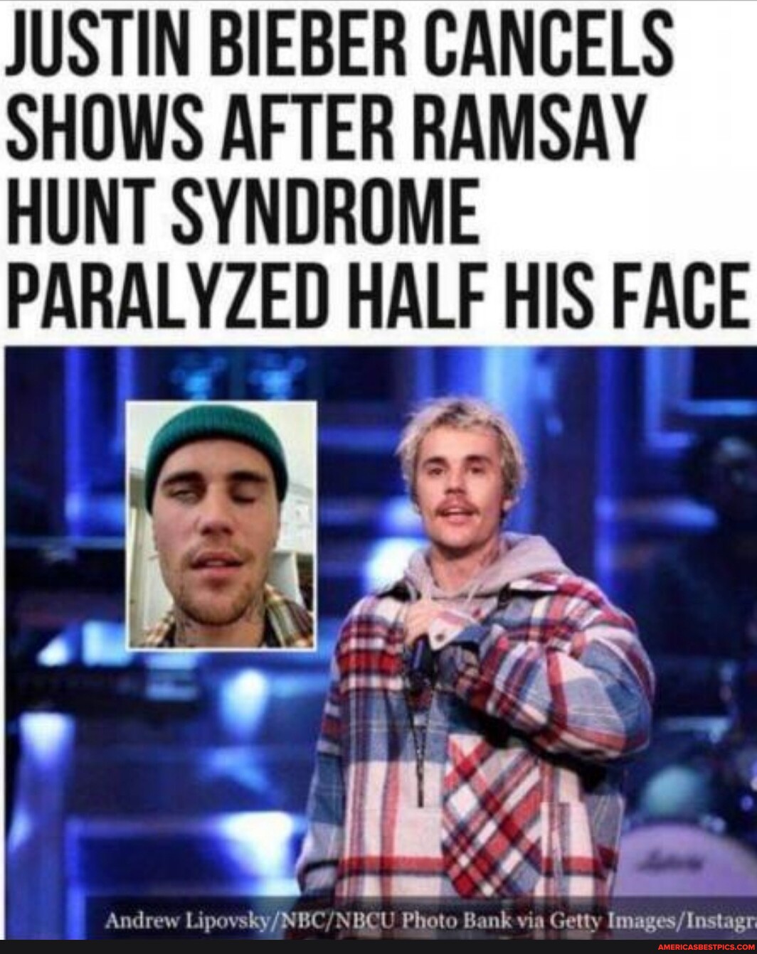 JUSTIN BIEBER CANCELS SHOWS AFTER RAMSAY HUNT SYNDROME PARALYZED HALF justin-bieber-cancels-shows-after-ramsay-hunt-syndrome-paralyzed-half