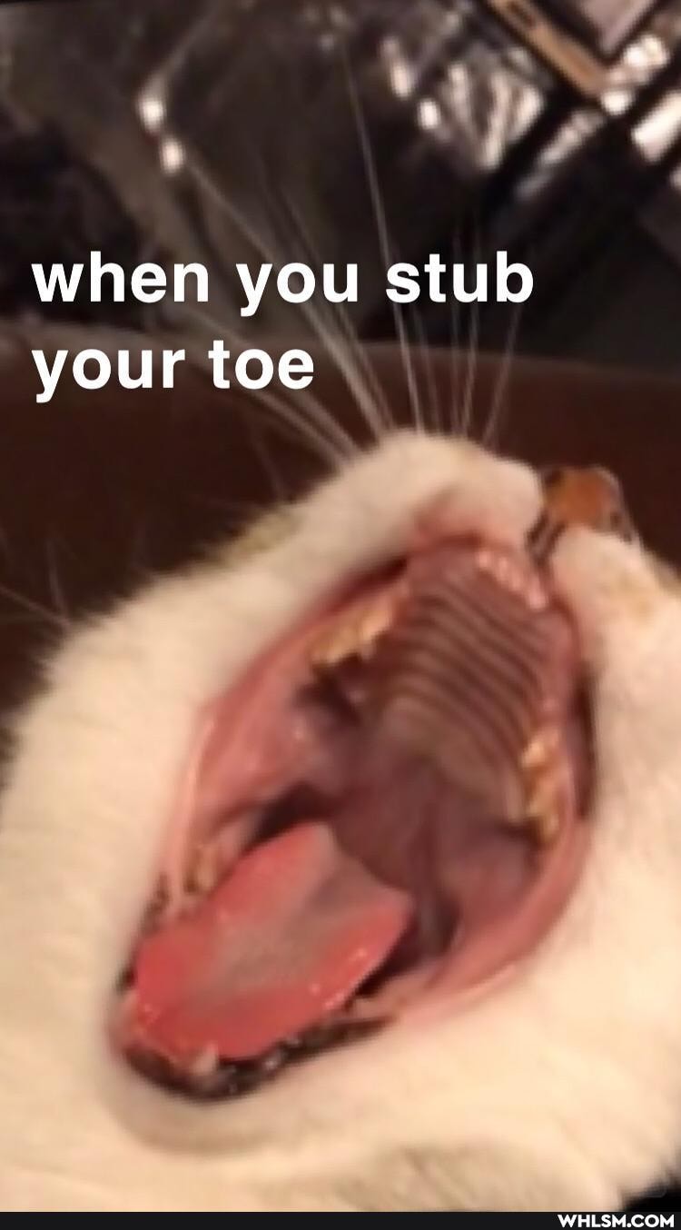 when you stub your toe