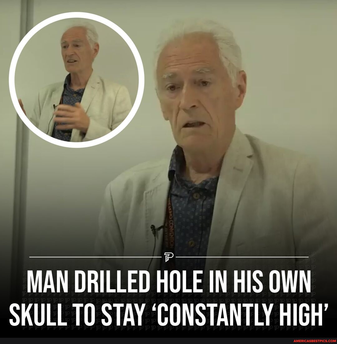 A man drilled a hole into his own skull so that he could remain