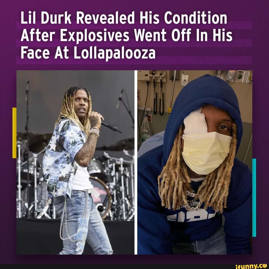 Lil Durk Revealed His Condition After Explosives Went Off In His Face At Lo Lapalooza Ifunny