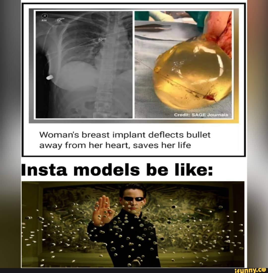 Womans Breast Implant Deflects Bullet Away From Her Heart Saves Her