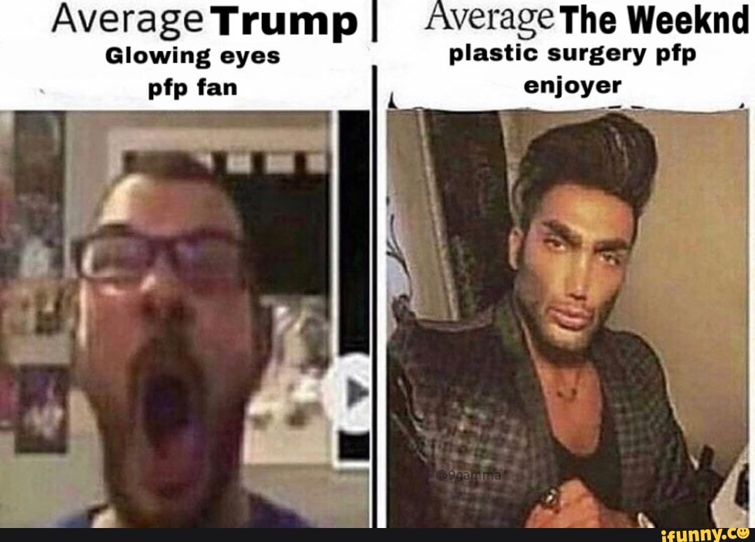 Average Trump I Average The Weeknd Glowing Eyes Plastic Surgery Pfp Pfp Fan Enjoyer