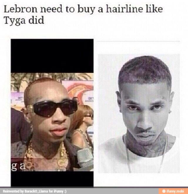 Lebron need
to buy a
hairline like
Tyga did