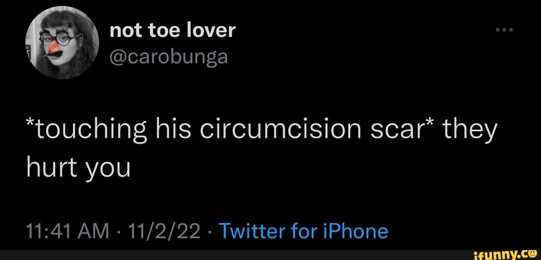 A not toe lover “touching his circumcision scar they hurt you AM