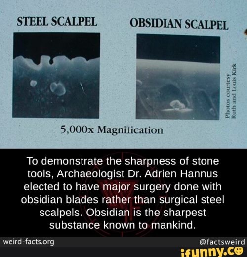 obsidian surgical scalpel