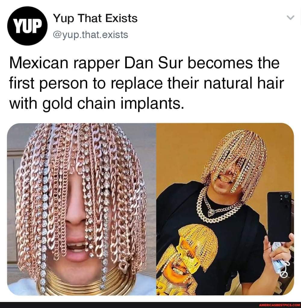 One World News  Infotainment on Instagram Gold Hair Anyone Mexican  rapper Dan Sur goes viral after getting gold chain hooks implanted into  scalp The 23yearold musician claimed