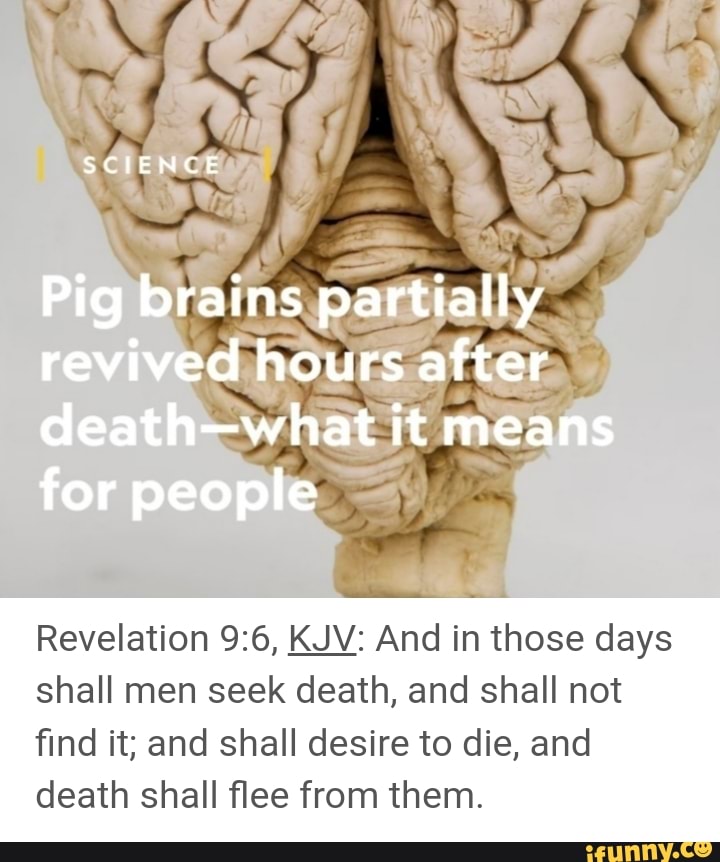 SCIENCE Pig brains partially revived hours after deathwhat it means