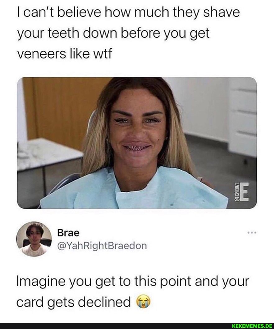 I can't believe how much they shave your teeth down before you get veneers like wtf
Imagine you get to this point and your card gets declined
