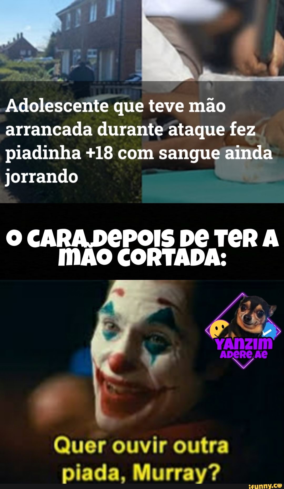Adolescente que teve mão arrancada durante ataque fez
piadinha +18 com sangue ainda jorrando
MÃO CARA.DÊPOIS DÊ TOR A CORTADA:
Quer ouvir outra piada, Murray?