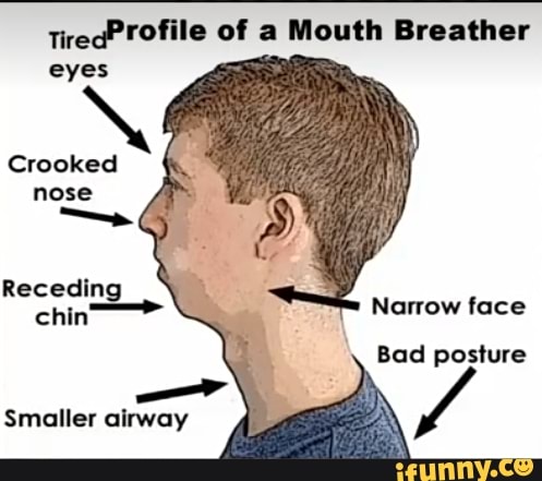 TiredProfile of a Mouth Breather eyes Crooked nose Receding chin Narrow ...