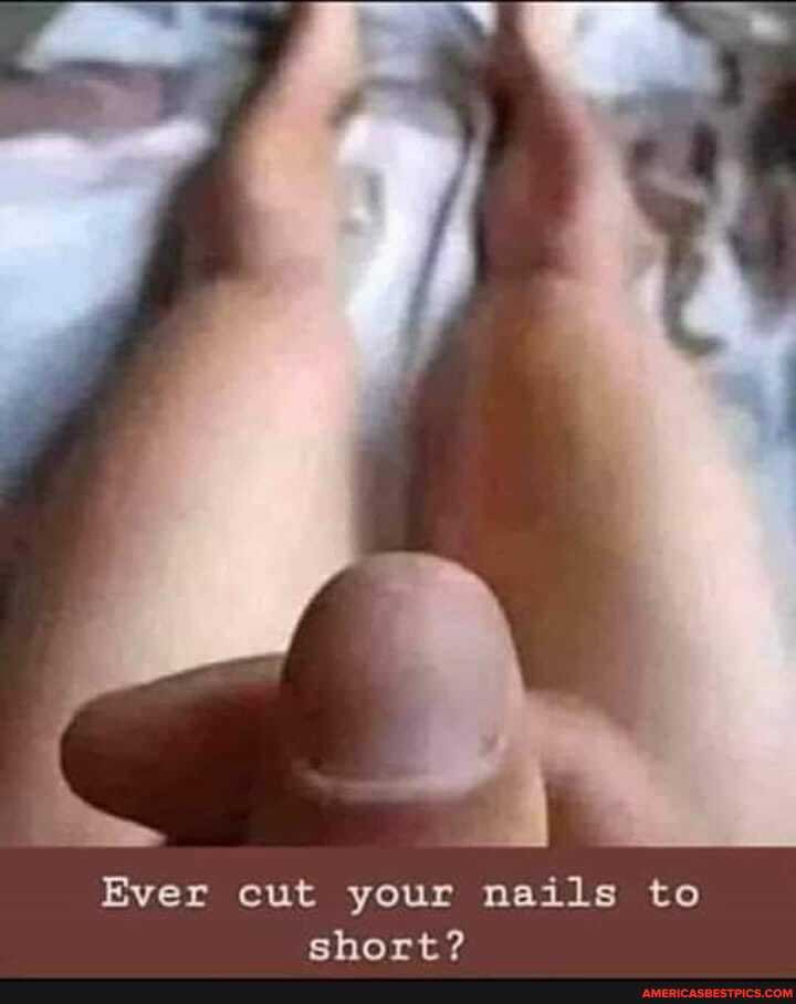 Ever cut your nails to short?