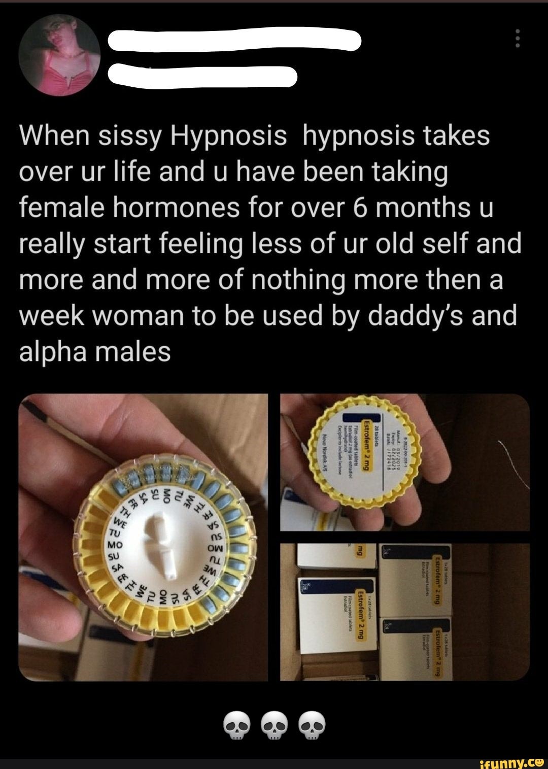 vive hypnosis reddit