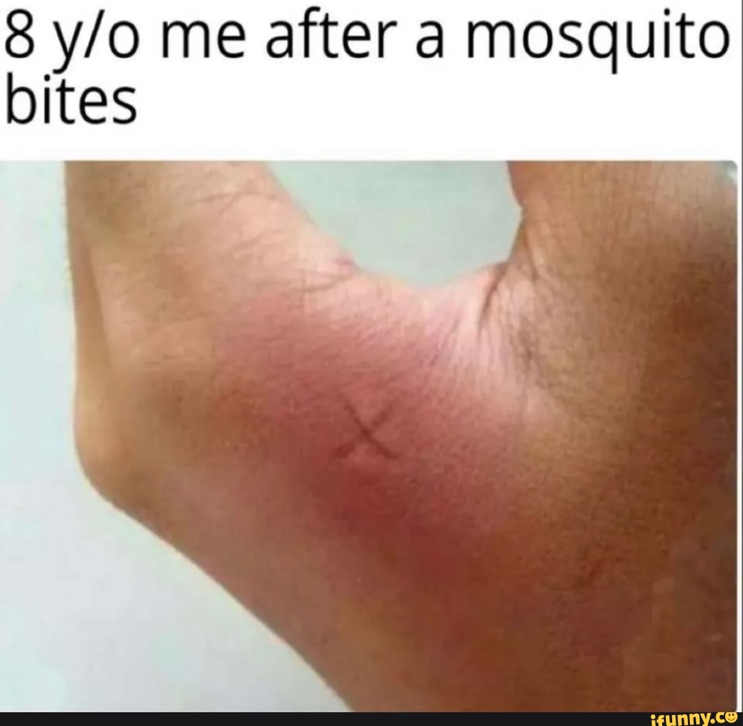 8 me after a mosquito bites