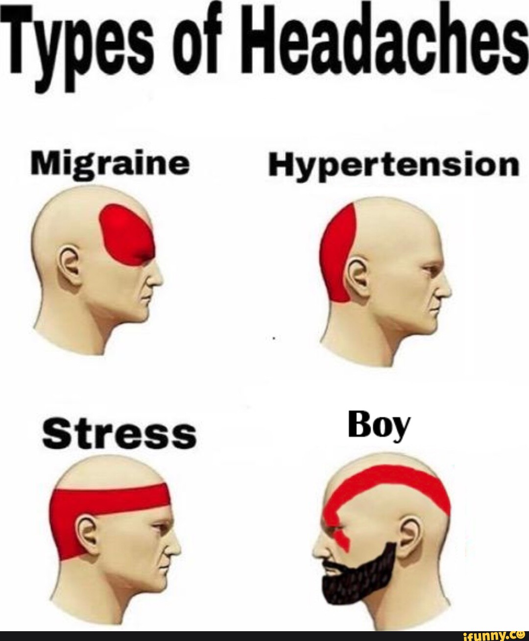 Types of Headaches Migraine Hypertension Stress - iFunny