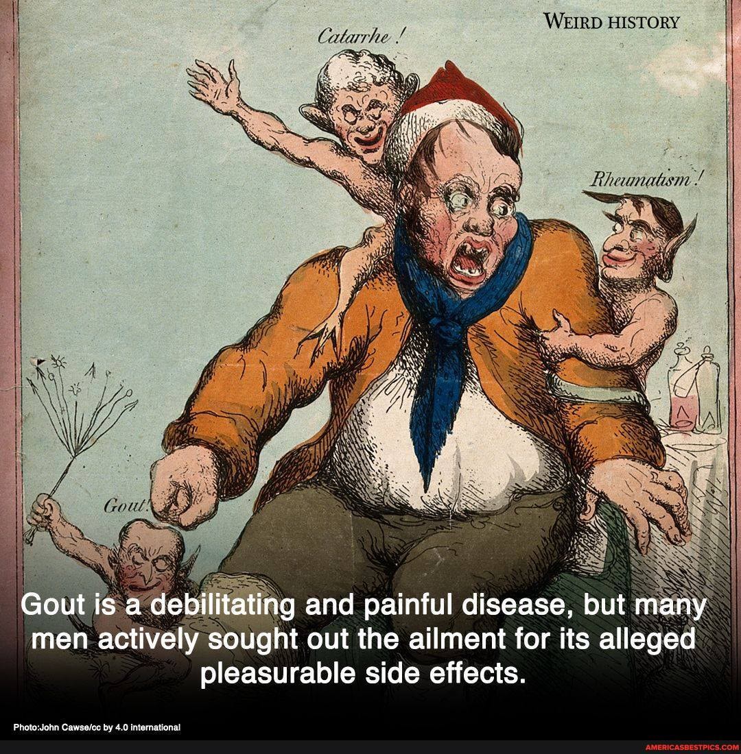WEIRD HISTORY
MAT HE
Gout is a debilitating lating and painful disease, but many men actively sought out the ailment for its alleged pleasurable side effects.