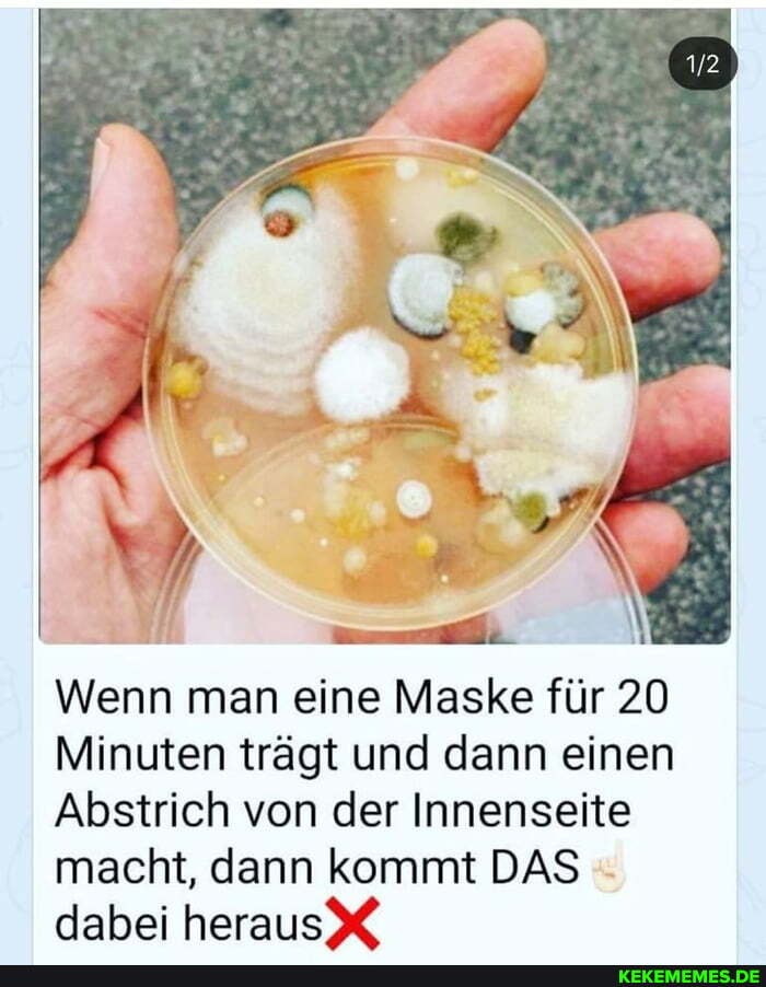 Wenn man eine Maske für 20
Minuten trägt und dann einen
Abstrich von der Innenseite macht, dann kommt DAS dabei heraus X