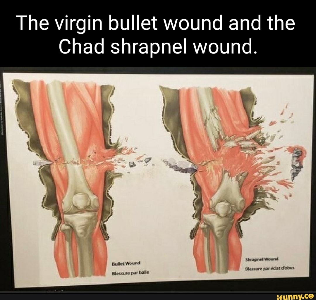 The virgin bullet wound and the Chad shrapnel wound. iFunny