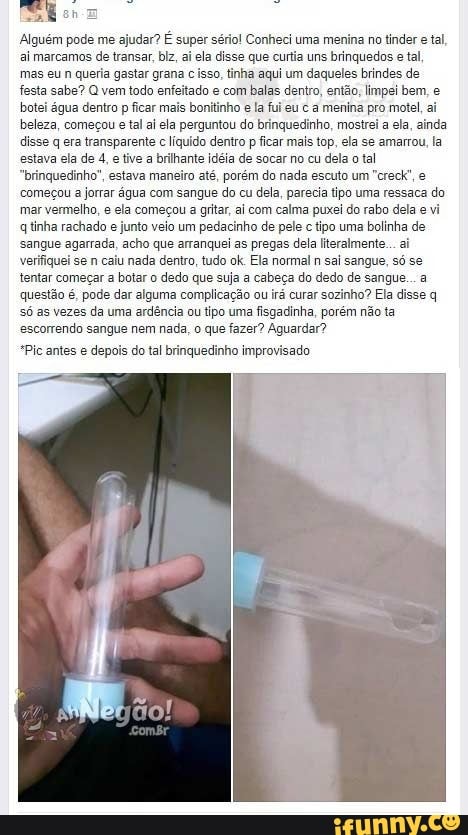 Alguém pode me ajudar? É super sério! Conheci uma menina no tinder e tal, ai marcamos de transar, biz, aí ela disse que curtia uns brinquedos e tal, mas eu n queria gastar grana isso, tinha aqui um daqueles brindes de festa sabe? Q vem todo enfeitado e com balas dentro, então, limpei bem, botei água dentro p ficar mais bonitinho e la fui eu c a menina pro motel, beleza, começou e tal ai ela perguntou do brinquedinho, mostrei a ela, ainda disse q era transparente c líquido dentro p ficar mais top, ela se amarrou, la estava ela de 4, e tive a brilhante Idéia de socar no cu dela o tal
"brinquedinho", estava maneiro até, porém do nada escuto um "creck, começou a jorrar água com sangue do cu dela, parecia tipo uma ressaca do mar vermelho, e ela começou a gritar, ai com calma puxei do rabo dela e vi q tinha rachado e junto veio um pedacinho de pele c tipo uma bolinha de sangue agarrada, acho que arranquei as pregas dela iteralmente... ai verifiquei se n calu nada dentro, tudo ok Ela normal n sai sangue, só se tentar começar a botar o dedo que suja a cabeça do dedo de sangue... a questão é, pode dar alguma complicação ou irá curar sozinho? Ela disse q só as vezes da uma ardência ou tipo uma fisgadinha, porém não ta escorrendo sangue nem nada, o que fazer? Aguardar?
"Pic antes e dep:
do tal brinquedinho improvisado