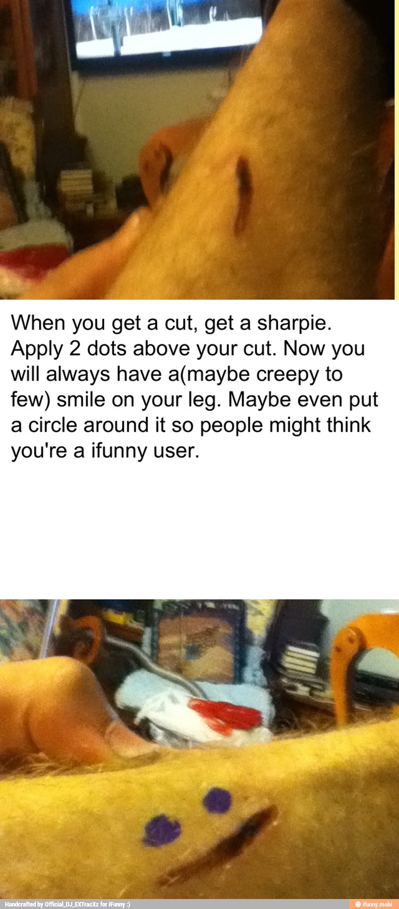 When you get a cut, get a sharpie.
Apply 2 dots above your cut. Now you
will always have a(maybe creepy to
few) smile on your leg. Maybe even put
a circle around it so people might think
you're a ifunny user.