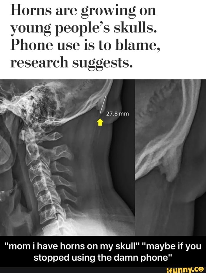Horns are growing 011
young people’s skulls.
Phone use is to blame,
research suggests.
"mom i have horns on my skull" "maybe if you
stopped using the damn phone" - "mom i have horns on my skull" "maybe if you stopped using the damn phone"
