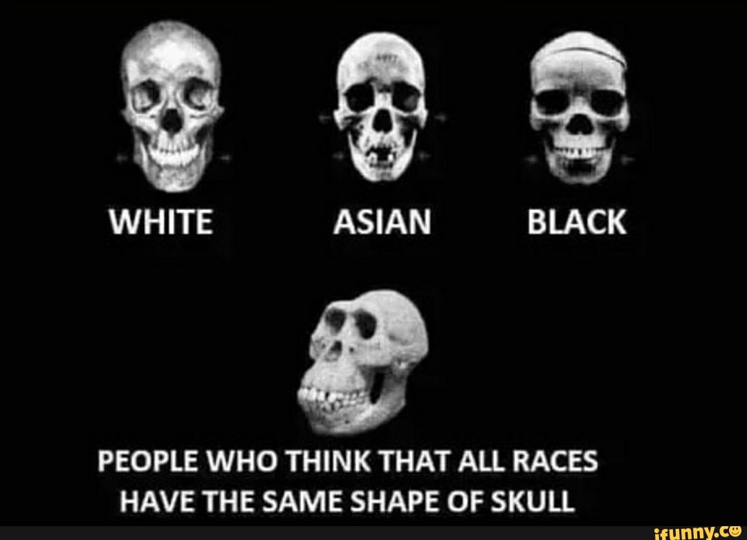 People Who Think That All Races Have The Same Shape Of Skull