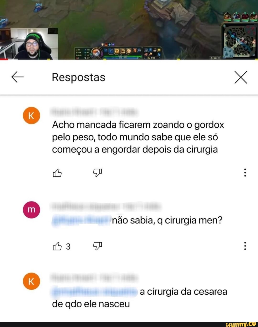 Respostas
Acho mancada ficarem zoando o gordox pelo peso, todo mundo sabe que ele só começou a engordar depois da cirurgia
oco
não sabia, q cirurgia men?
a cirurgia da cesarea de qdo ele nasceu