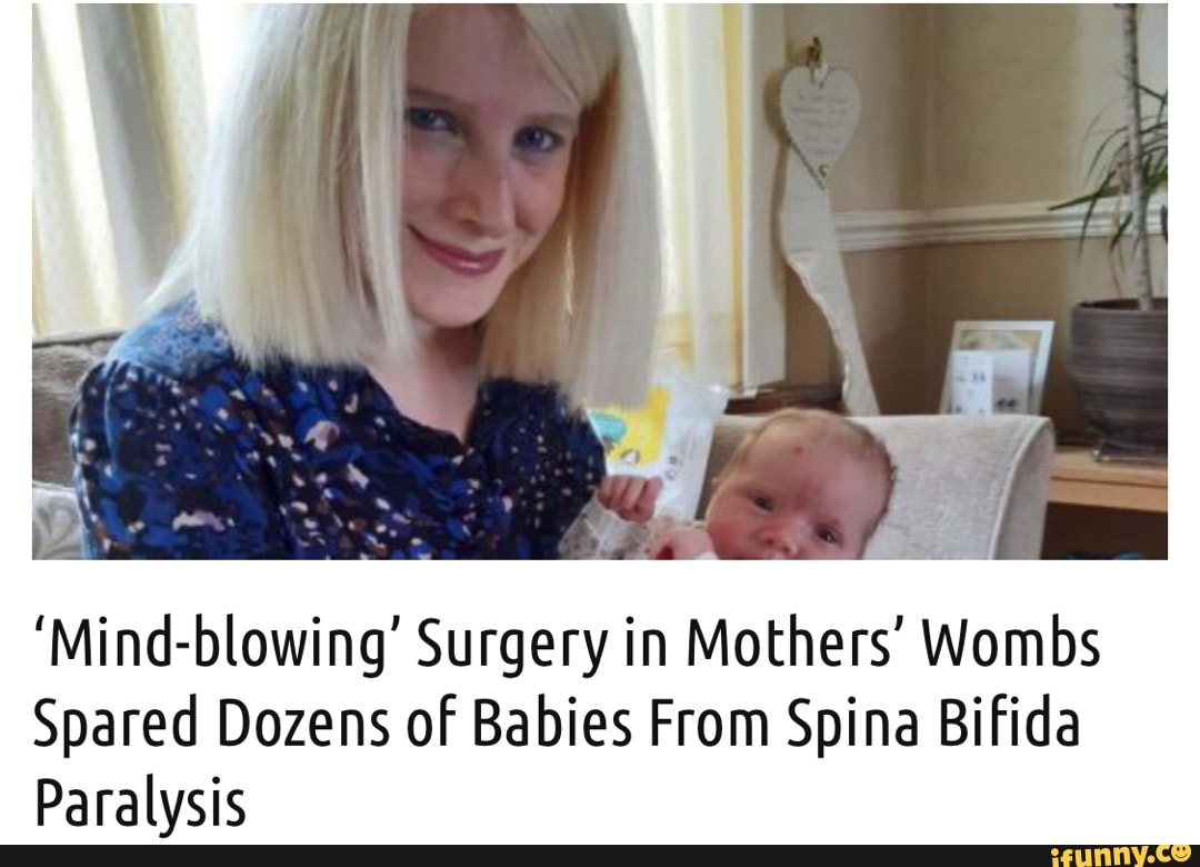 Mind Blowing Surgery In Mothers Wombs Spared Dozens Of Babies From