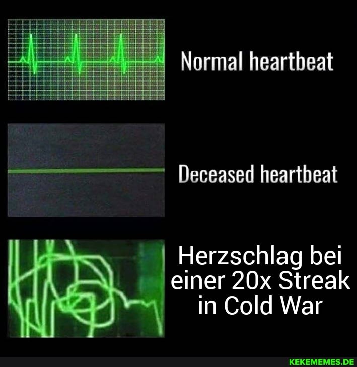 Normal heartbeat
Deceased heartbeat
I I I Herzschlag bei einer Streak in Cold War