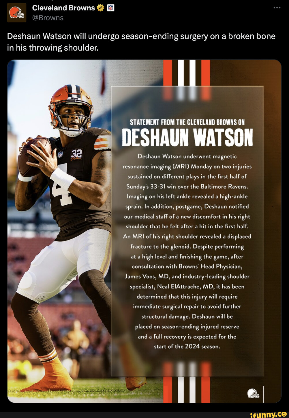 Cleveland Browns Browns Deshaun Watson Will Undergo Season-ending ...