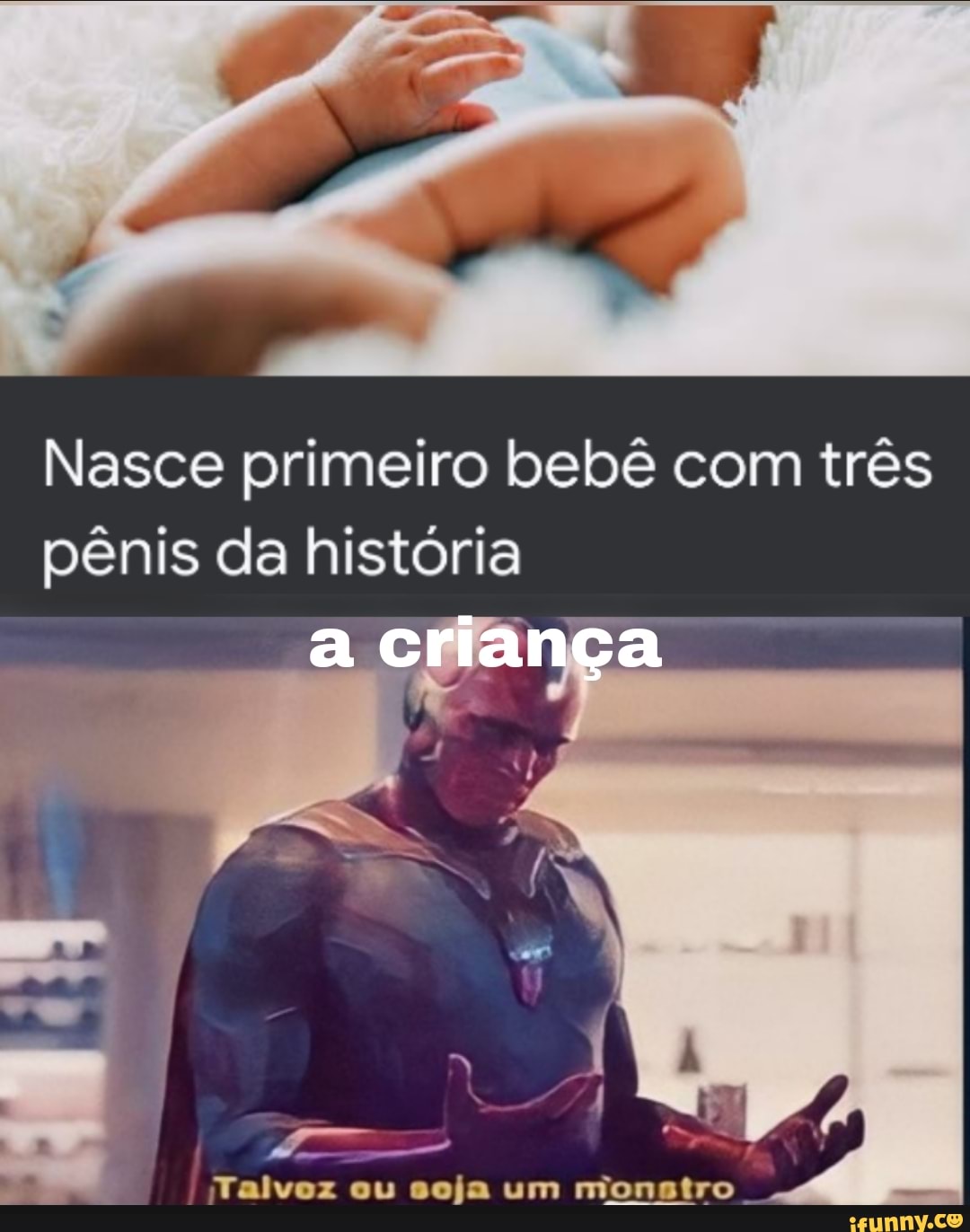 Nasce primeiro bebê com três pênis da história
criança
Talvoz ou soja um mionstro