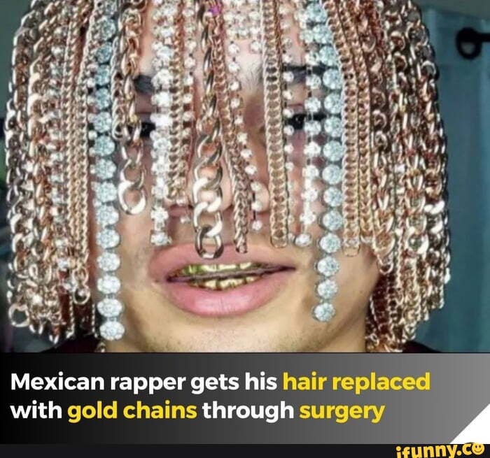 00000 Mexican Rapper Gets His Hair Replaced With Gold Chains Through 00000-mexican-rapper-gets-his-hair-replaced-with-gold-chains-through
