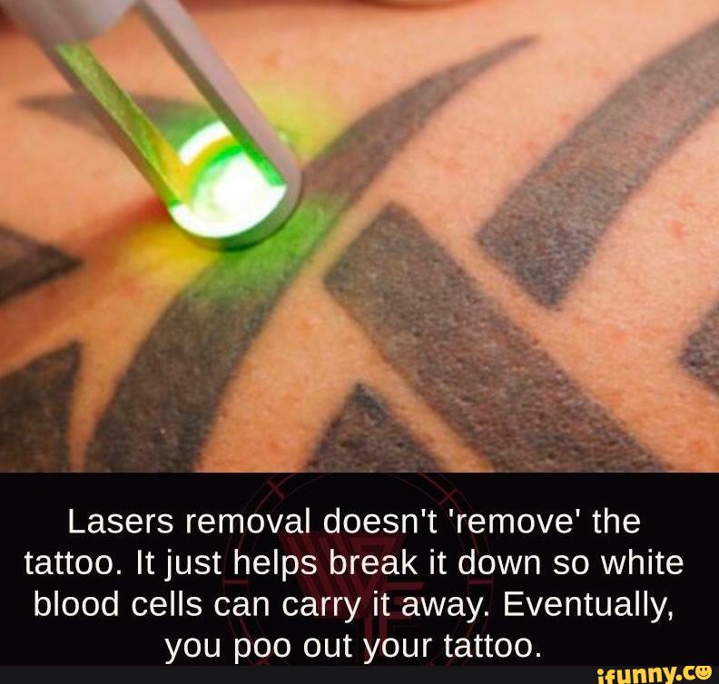 Не отпускай фильм 2019. Remove signs. Don't let go фильм 2019. Don't delete the kisses. Лазерное нанесение тату.