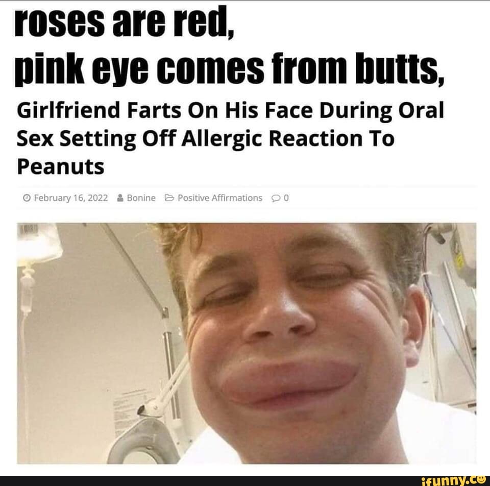 Girlfriend Farts On His Face During Oral Sex Setting Off Allergic Reaction  To Peanuts February 16,2022 & Bonine Positive Affirmations - iFunny