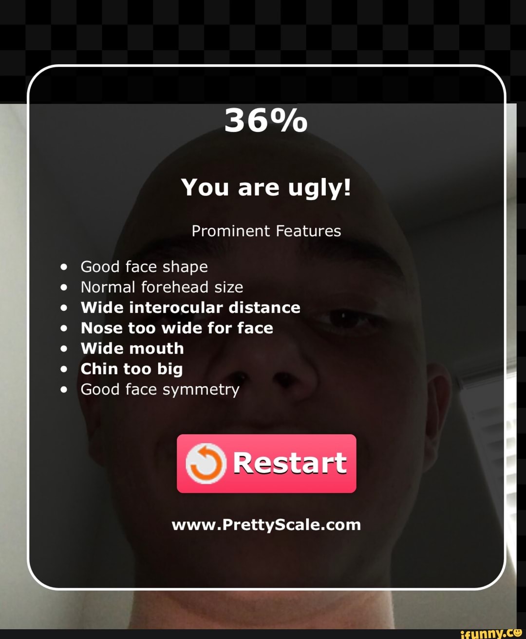 You are ugly! Good face shape Normal forehead size Wide interocular