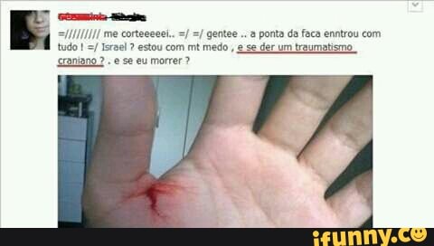 INI! me corteceeet.. a ponta da faca entrou com
tudo
Israel estou com mt medo ¢ se der um traumatismo
sromiano e se eu morrer?