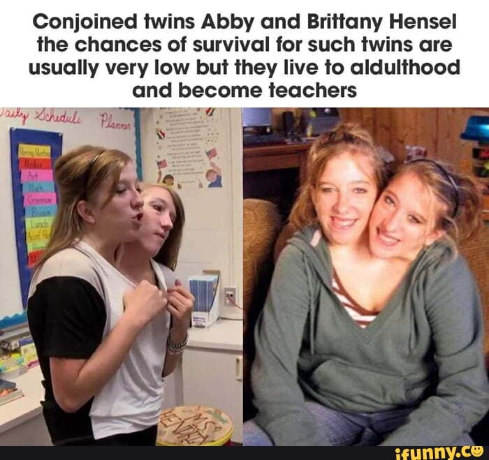 Conjoined twins Brittany & Abby Hensel are an inspiration! - 9GAG