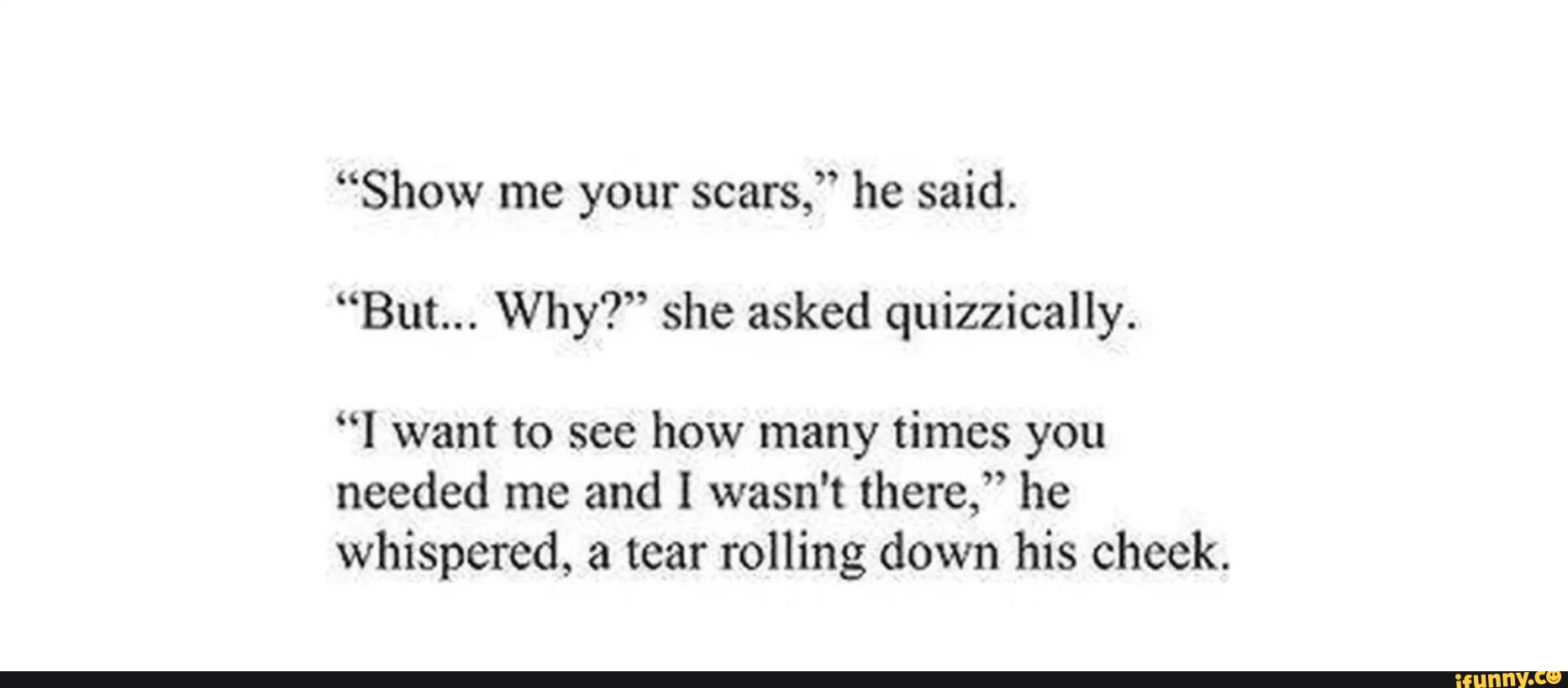 “Show me your scars,” he said. “But... Why?” she asked quizzically ...