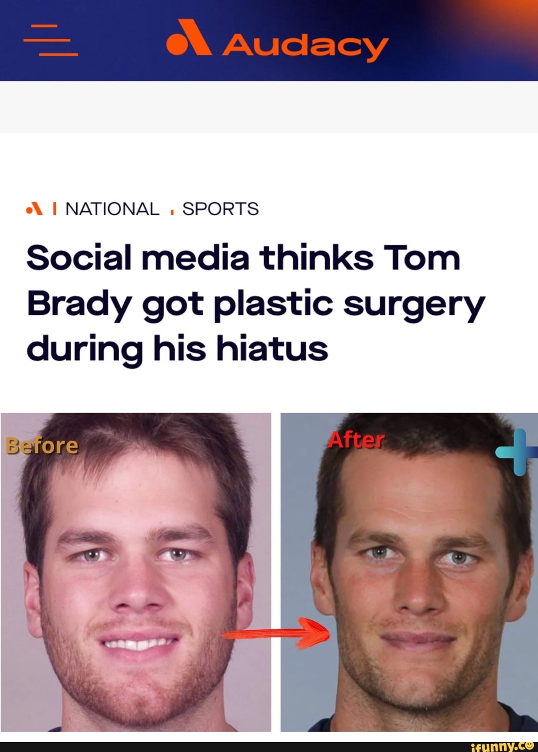 Twitter thinks Tom Brady got plastic surgery during hiatus