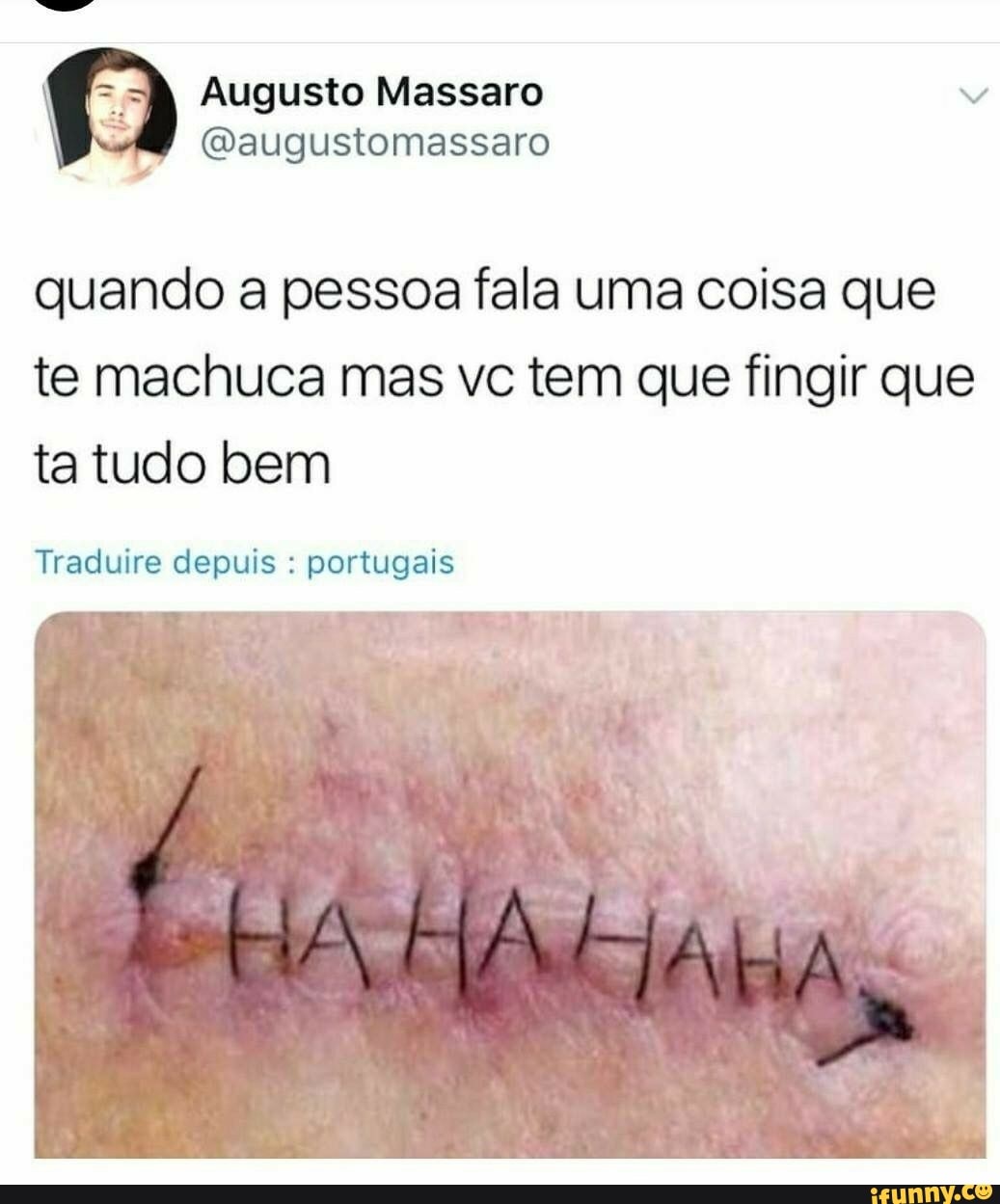quando a pessoa fala uma coisa que
te machuca mas vc tem que fingir que
ta tudo bem
Traduire depuis portugais