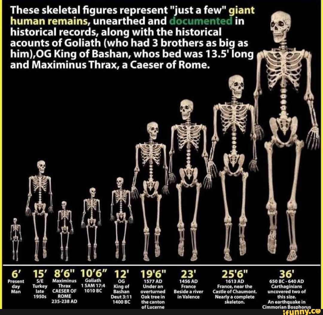 These skeletal figures represent 