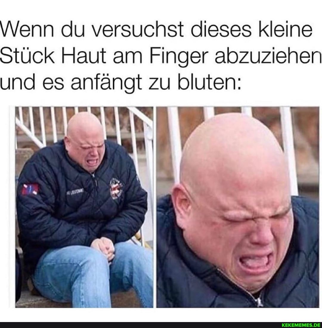 Wenn du versuchst dieses kleine
Stück Haut am Finger abzuziehen und es anfängt zu bluten:
je