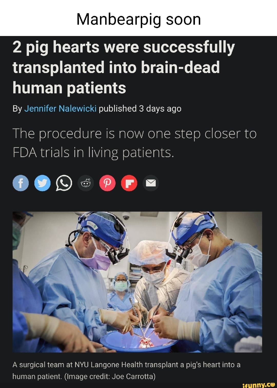 Manbearpig soon 2 pig hearts were successfully transplanted into brain