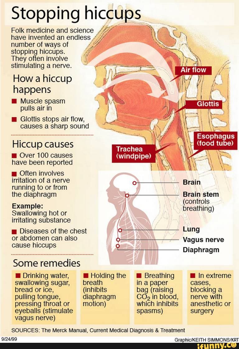 Hiccups; The causes and how to cease them. - Stopping hiccups Folk ...