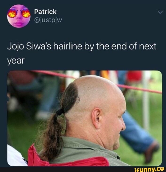 Jojo Siwa S Hairline By The End Of Next Ifunny