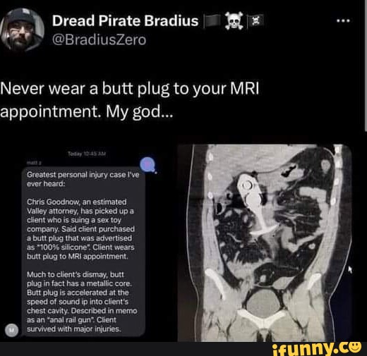 Dread Pirate Bradius Bradiuszero Never Wear A Butt Plug To Your Mri Appointment My God 1775