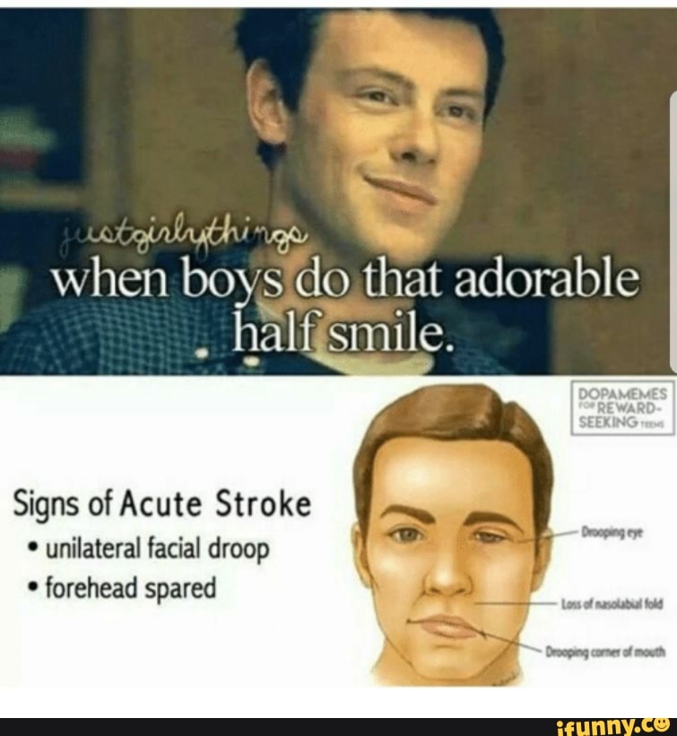 When boy‘sgig that adorable lgalfsmile. Signs of Acute Stroke