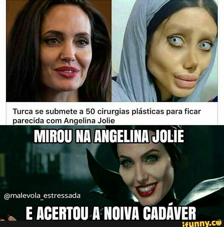 Turca se submete a 50 cirurgias
para ficar
parecida com Angelina Jolie
(amalevola estressada AY EACERTOU A