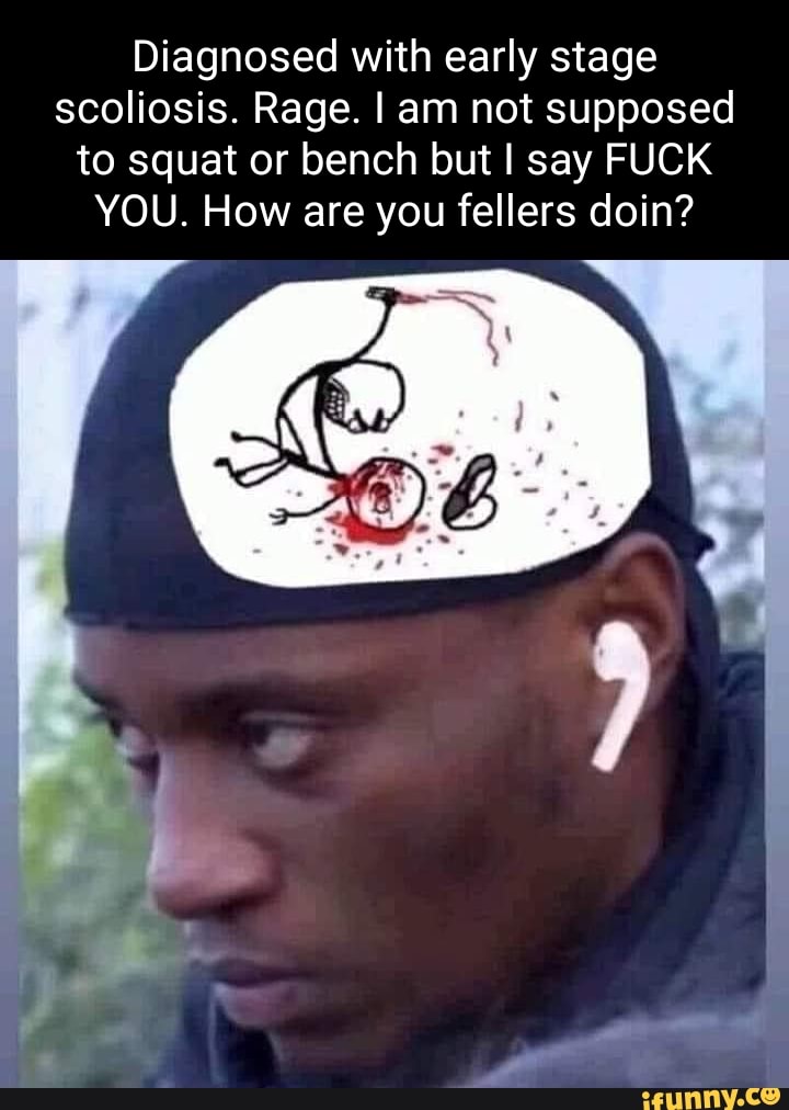 Diagnosed with early stage scoliosis. Rage. I am not supposed to squat