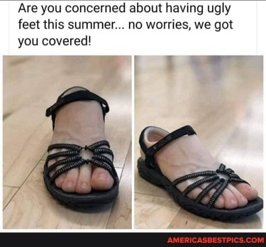 Are you concerned about having ugly feet this summer... no worries, we got you covered!